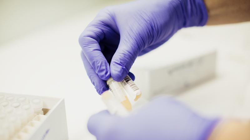 Händer med blå plasthandskar håller i tre provrör.