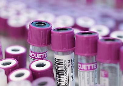 Provrör med lila kork som står i ett ställ