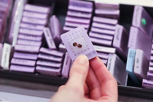 En hand som håller i ett vävnadsprov. I barkunden syns fler vävnadsprover som ligger i en låda